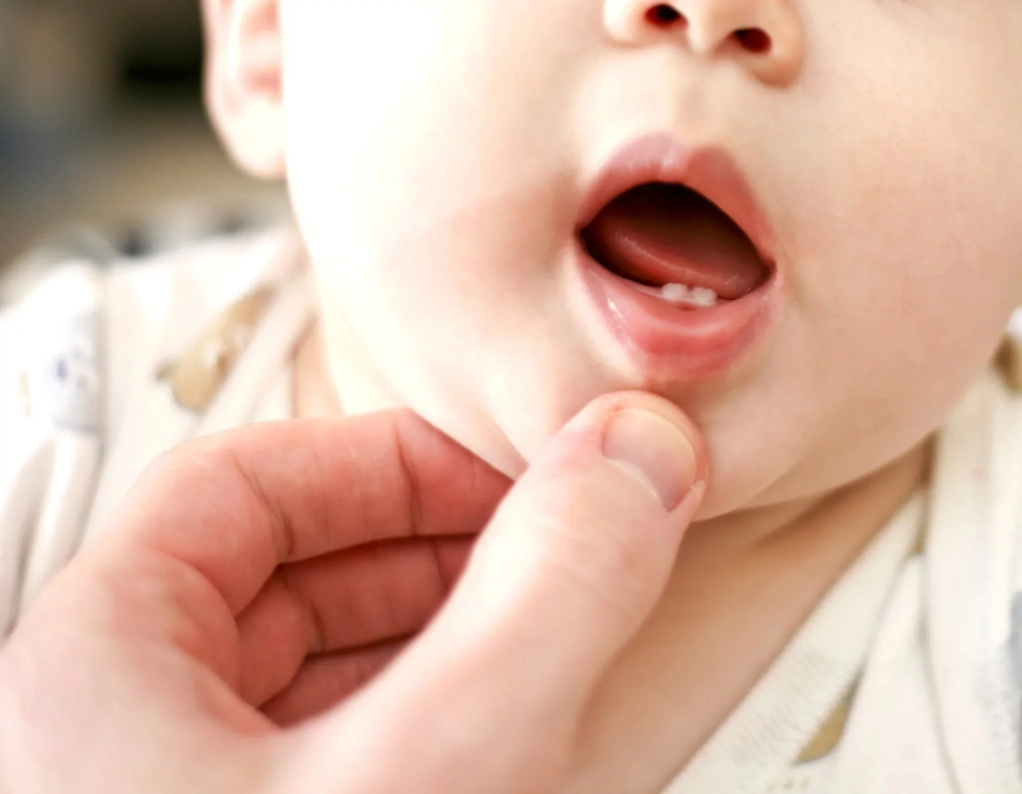 Photos Gencives Poussée Dentaire Bébé : Reconnaître les Signes