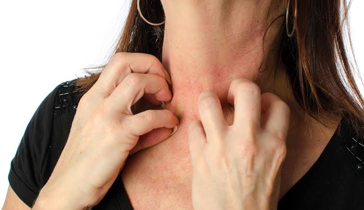 Symptômes allergie pollen : tout comprendre et se soigner